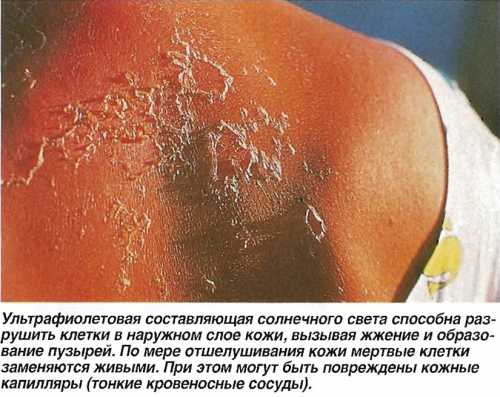 боязнь отверстий